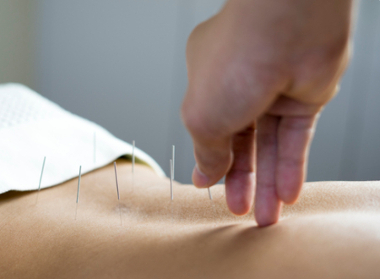 acupuncture for back pain