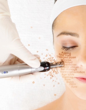 Micro-needling DpDerm 3MD