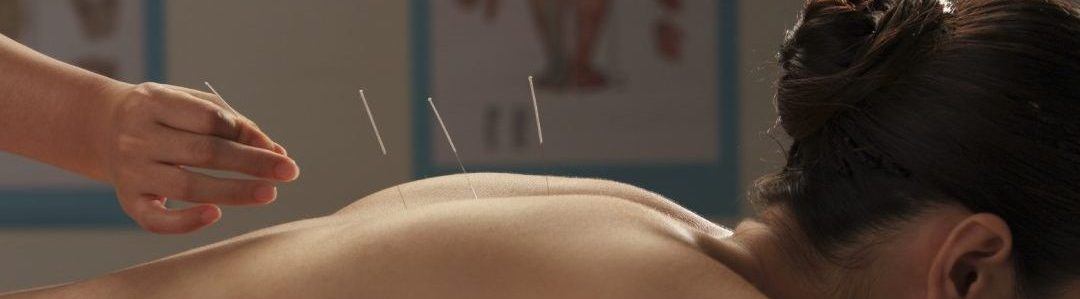 Pain and Acupuncture