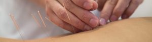 Quality acupuncture treatments