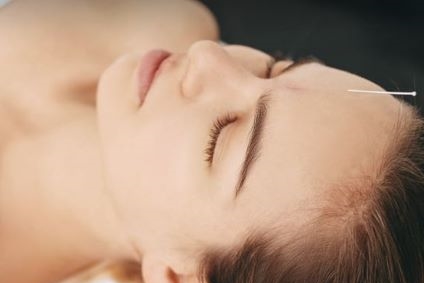 Relaxing acupuncture treatment
