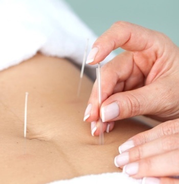 Acupuncture treatment on abdomen