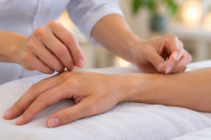 Needling acupuncture points for allergies